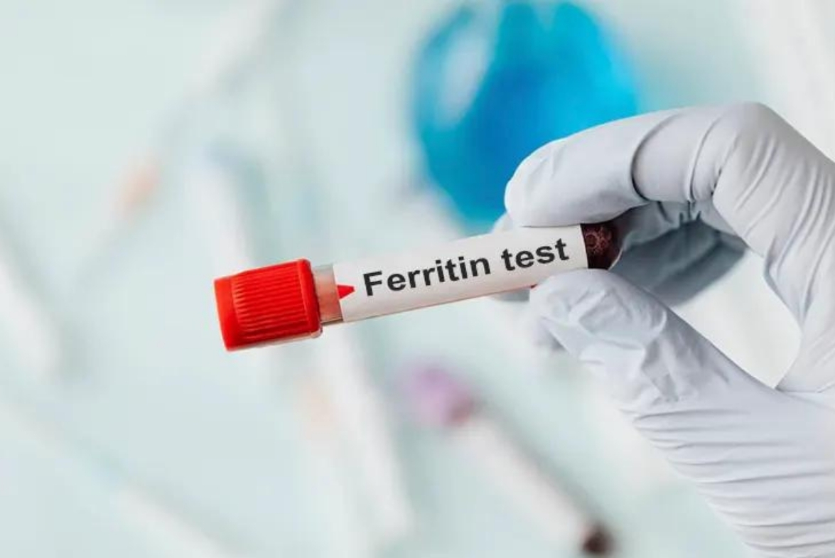 Ferritin Nedir Ferritin Düşüklüğü ve Yüksekliği Nedenleri ile Kan